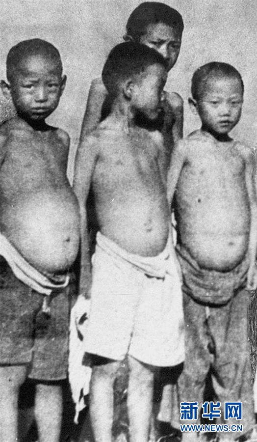 (紅土地“往事新說”·圖文互動)(6)昔日送“瘟神”  今朝健康促小康